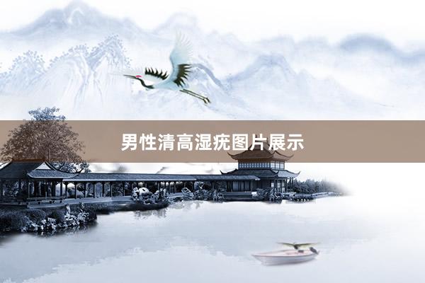 男性清高湿疣图片展示